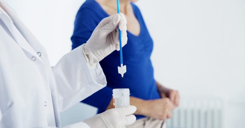 All You Need to Know About Pap Smear Test
